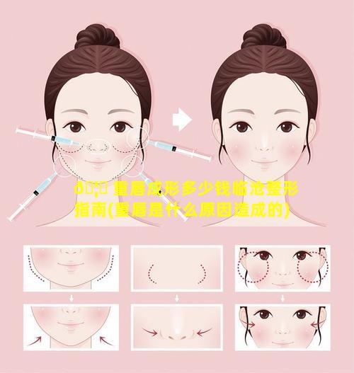 🦉 重唇成形多少钱临沧整形指南(重唇是什么原因造成的)